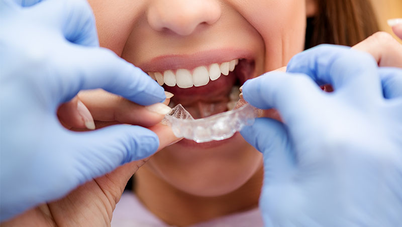 bursa ortodontist 2 1