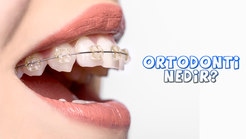 Ortodonti Nedir? Nasıl Tedavi Edilir?