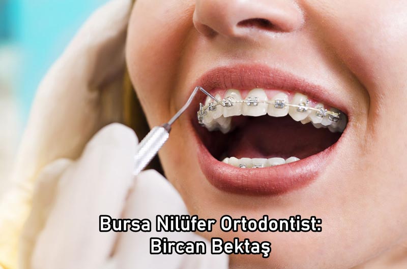 ortodontist bursa