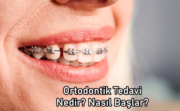 ortodontik tedavi nedir