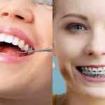 Post list-yeni 8 bursa ortodontist, bursa ortodonti, bursa ortodonti uzmanı, bursa diş teli tedavisi, bursa şeffaf plak tedavisi, bursa ortognatik cerrahi, bursa ortodonti fiyatları, bursa ortodonti yorumları, bursa ortodonti tavsiye, bursa çocuk ortodontisi, bursa yetişkin ortodontisi, bursa estetik ortodonti, bursa telsiz ortodonti, bursa sabit ortodonti, bursa ortodonti randevu,