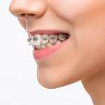 Post list-yeni 6 Bursa ortodontist, Bursa ortodonti, Bursa ortodonti uzmanı, Bursa diş teli tedavisi, Bursa şeffaf plak tedavisi, Bursa ortognatik cerrahi, Bursa ortodonti fiyatları, Bursa ortodonti yorumları, Bursa ortodonti tavsiye, Bursa çocuk ortodontisi, Bursa yetişkin ortodontisi, Bursa estetik ortodonti, Bursa telsiz ortodonti, Bursa sabit ortodonti, Bursa ortodonti randevu,